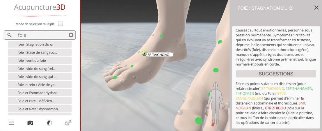 Fiches pathologies et syndrômes